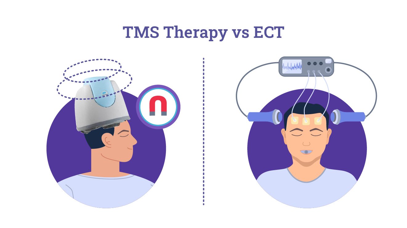 TMS vs ECT - Key Differences Explained - Dr Kunal Bahrani